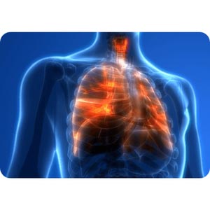lung injury